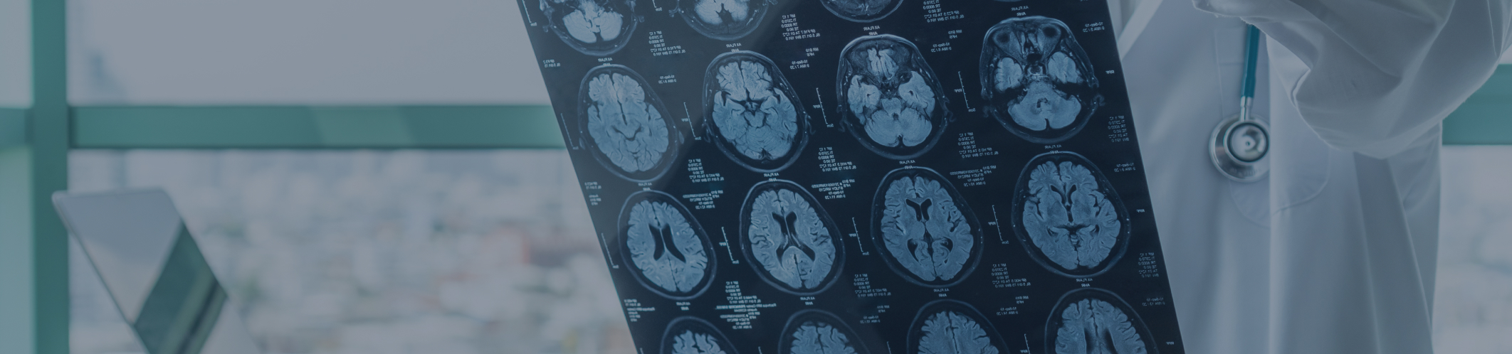 Traumatic Brain Injury